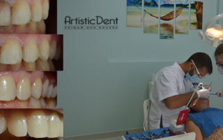 Dd-devitali-cover-site