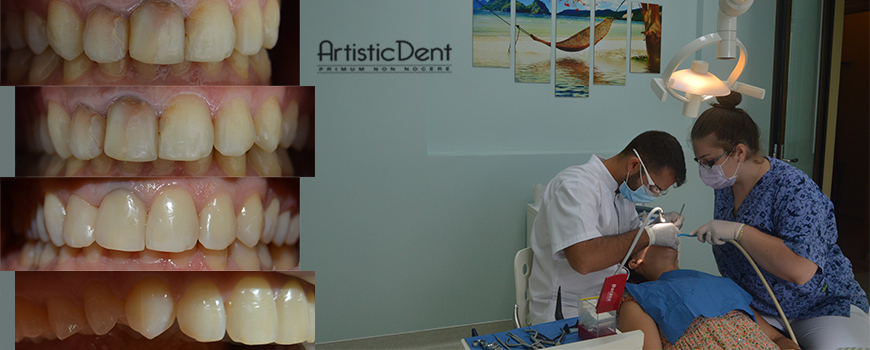 Dd-devitali-cover-site