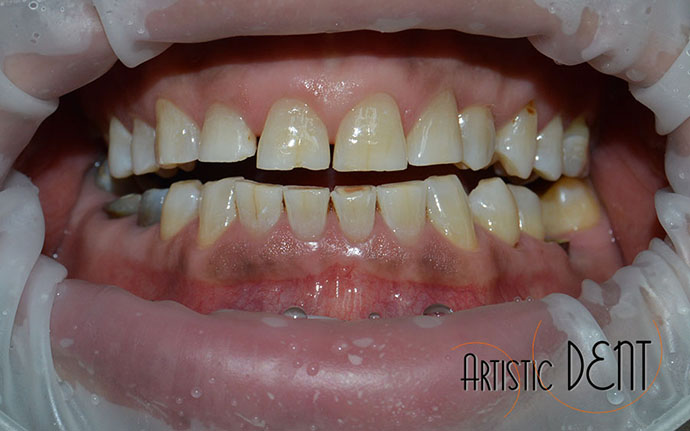 albire-dentara-in-cabinet-nr1