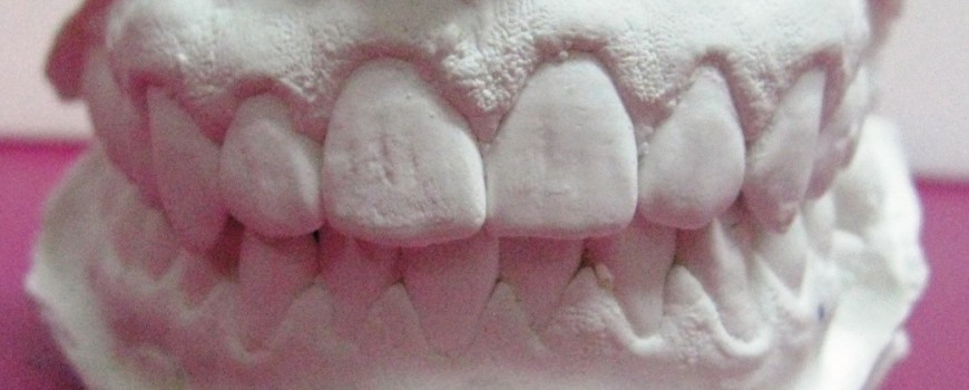 aparat-dentar-invizibil-870x350