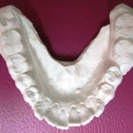 aparat-ortodontic-150x150