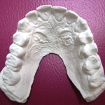 aparatdentarsocialsix-150x150