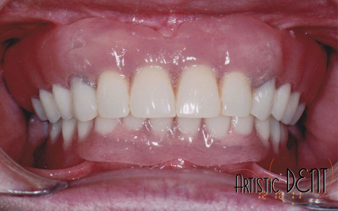 reabilitare-caz-complex-nr1