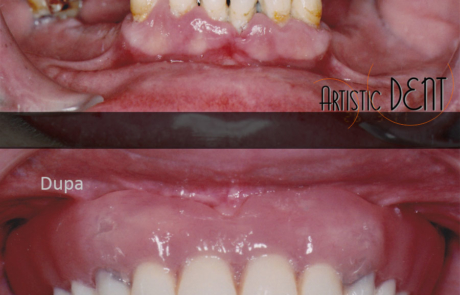 reabilitare-caz-complex-nr2