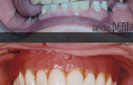 reabilitare-caz-complex1