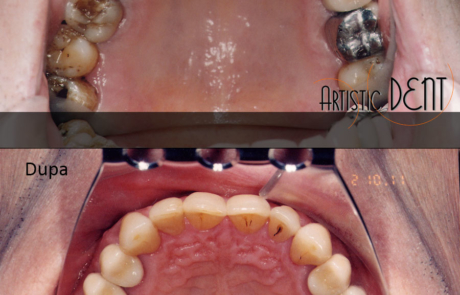 reabilitare-caz-complex2