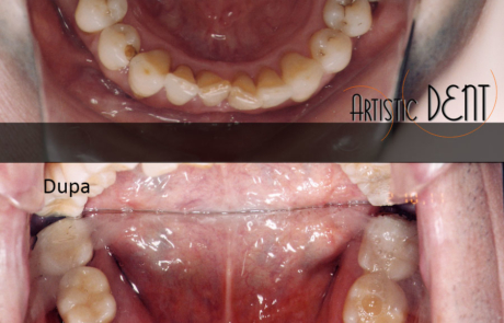 reabilitare-caz-complex3