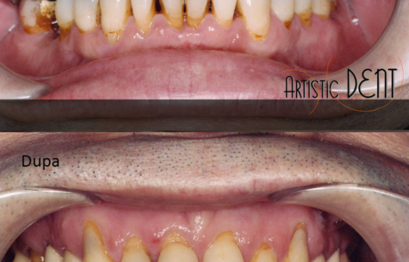 reabilitare-caz-complex4