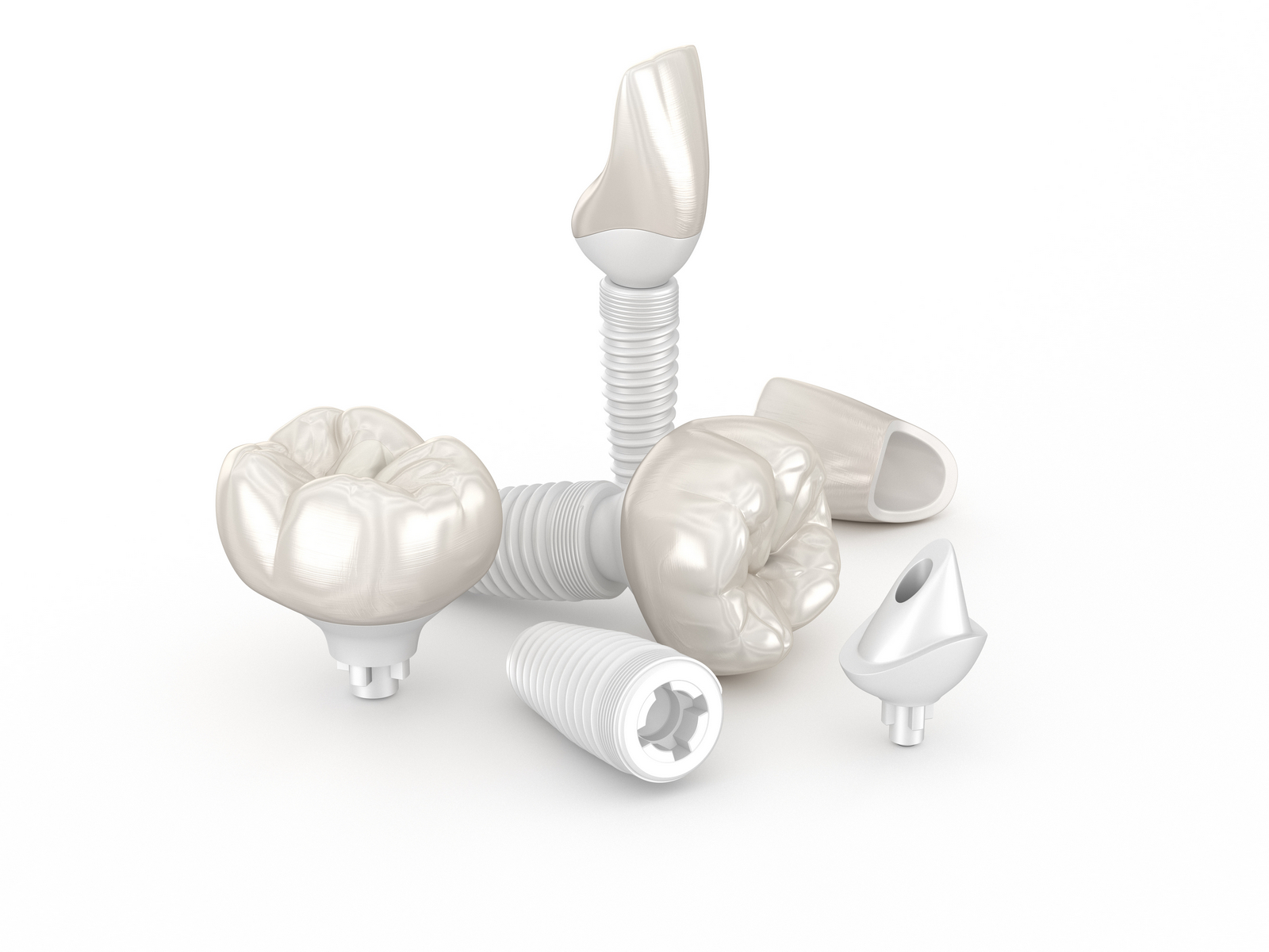 Protetica pe implant- estetică superioară